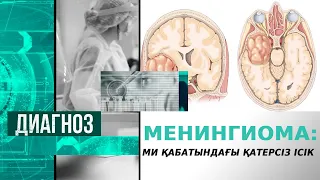 Менингиома: Ми қабатындағы қатерсіз ісікті қалай емдейді? | Диагноз