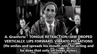 TONGUE RETRACTION, LIPS FORWARD, VIBRATO PULSATIONS etc.