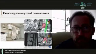 Хирургическое лечение злокачественных опухолей позвоночника