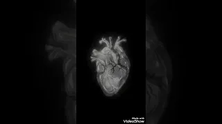 Idris & Leos - Меланхолик (slowed) 🤍