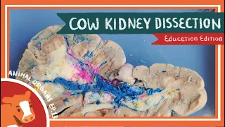 Kidney Dissection || A Man of My Kidney [EDU]
