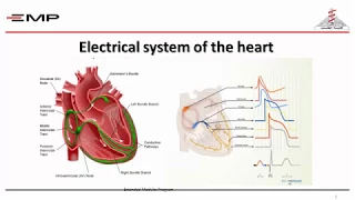 Bradyarrhythmias 1