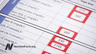 How Do We Know that Cholesterol Causes Heart Disease?