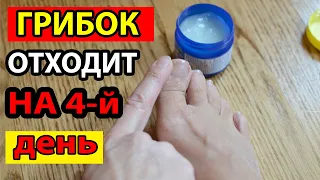 This VIGOROUS Soviet Ointment EATS UP The Entire NAIL FUNGUS Without A Trace! TOENAIL FUNGUS TREATME