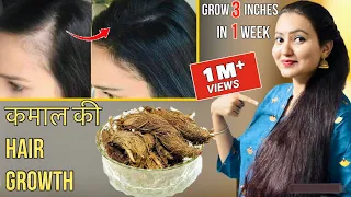 30 Days Extreme Hair Growth Challenge : कितने भी झड़ चुके हों बाल, इस रेमेडी से होगी कमाल की Growth