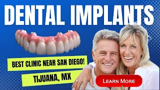 Cheap All On-4 Dental Implants: $5,499 Tijuana's Top Dental Implant Destination l (858) 544-3900