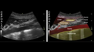 GASTRIC ULTRASOUND