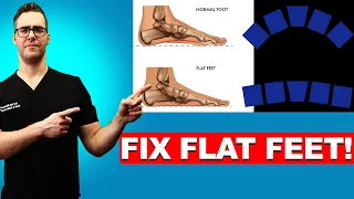 How To FIX Flat Feet: 16 BEST Home Remedies [Shoes & Arch Insoles]