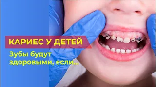 Откуда берется кариес у маленьких детей? Ответ в нашем видео