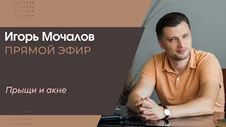 "Прыщи и акне. Психосоматика." Прямой эфир от 27.05.2020 г.