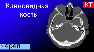 Лучевая анатомия клиновидной кости