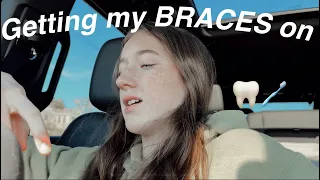Getting my braces on VLOG!