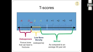 T Score explained