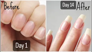 Grow your nails in just 2 weeks! HOW TO GROW NAILS FASTER!