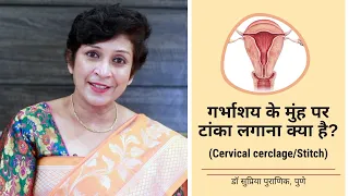 बच्चेदानी/गर्भाशय के मुंह पर टांका लगाना क्या है?| Cervical cerclage/Stitch | Dr Supriya Puranik