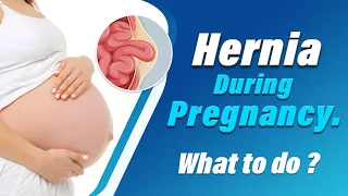 Hernia During Pregnancy | Hernia Complications in Pregnancy - What To Do? | Dr Parthasarathy