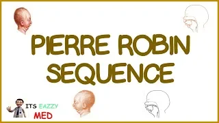 Pierre Robin Sequence (PRS)