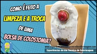 Como é feita a limpeza e a troca de um Bolsa de Colostomia?