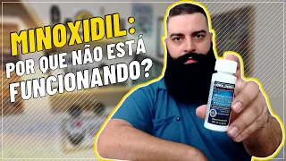 MINOXIDIL: Por que não funciona? 5 RAZÕES por que o MINOXIDIL não FUNCIONA na BARBA!