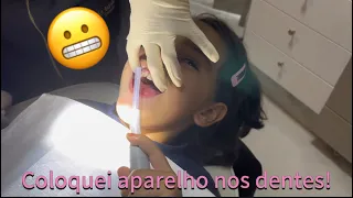 Colocando aparelho nos dentes! 😬 | Bia Miyamoto