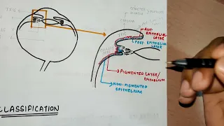 Diseases of UVEAL TRACT ||  Anterior Uveitis - PART 1 || Uveitis Classification