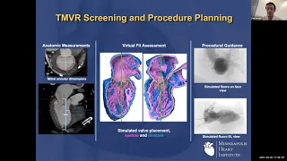 Miami Valves 2021 Virtual Lecture Series Session 3-  5/5/2021