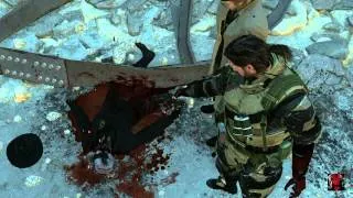 ［MGS5:TPP］スカルフェイスの手足切断シーン　グロシーン