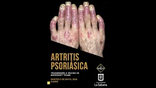 Artritis Psoriásica  IMIGUS