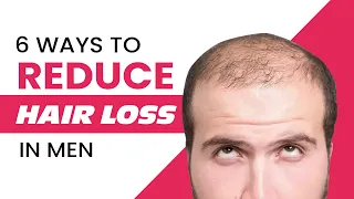 6 Ways to Reduce Hair Loss in Men | Profile Studios