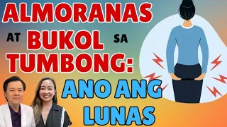 Almoranas at Bukol sa Tum-bong: Ano ang Lunas. - By Doc Willie Ong