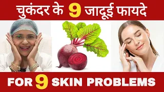 चुकंदर के 9 जादूई फायदे| 9 फायदा चौंका देगा😲  #beetroot #skin #glow #trending