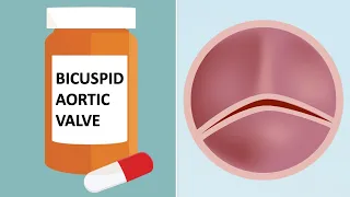 Bicuspid Aortic Valves & Medication: Top 7 Facts with Dr. Luis Castro