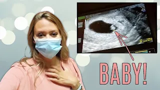 FIRST ULTRASOUND OF OUR FIRST BABY!! | 6 Weeks 5 Days Pregnant | Infertility Journey