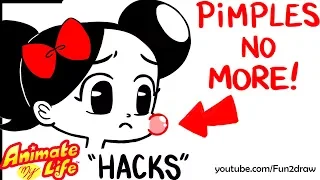10 Ways to "Get Rid Of" PIMPLES! | Animate My Life HACKS