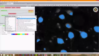 Avizo 9.0: 4.2 Hysteresis Thresholding, and Watershed Transforms.