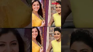 Anushka Sharma to Janhvi Kapoor: Bollywood actresses before & after cosmetic surgery 😱 #shorts
