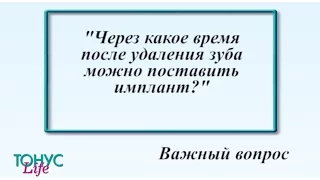 Через какое время после удаления зуба можно поставить имплант?