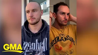 TikTok influencer who started losing hair at 19 breaks stigma around male hair loss l GMA