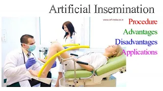 Artificial Insemination in humans I Procedure, types, Advantages, Disadvantages and Applications
