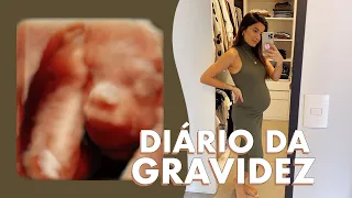 Dores, contrações, comprinhas para a mamãe 🤰🏽 | DIÁRIO DA GRAVIDEZ | 22 semanas | Vanessa Lino