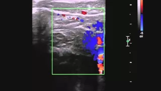 SonoSim Ultrasound Video Challenge - Abdomen