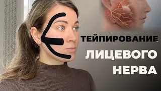 Тейпирование Лицевого Нерва - самая простая аппликация