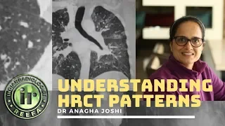 Understanding Lung HRCT patterns |  Dr Anagha Joshi | Nodules & Septal Thickening
