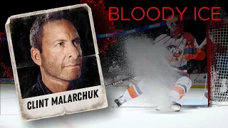 Clint Malarchuk: Blood Ice // Ice Hockey. Tragedies and Miracles