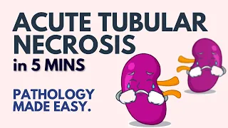 Acute Tubular Necrosis in 5 Minutes l Pathology Made Easy