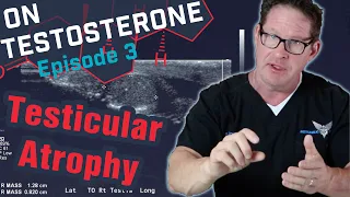 Testicular Atrophy - On Testosterone Ep. 3