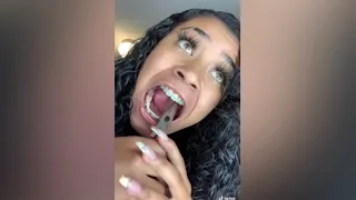 Orthodontist Reacts! Girl Uses Wire Cutters On Braces! #Shorts