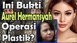 Ini Bukti Aurel Hermansyah Operasi Plastik, Benarkah?