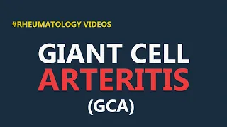 Giant Cell Arteritis or Temporal Arteritis - Features, Diagnosis & Treatment