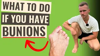 Bunions | How You Can IMPROVE Pain & Function